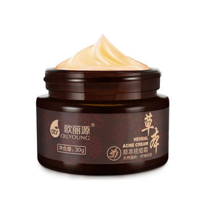 Facial Face Cream  Anti-Pimple Acne Herbal  Whitening Cream