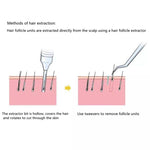 Fue Hair Transplant Hair Follicle Extractor Scarless For Hair Thinning and Balding Treatment