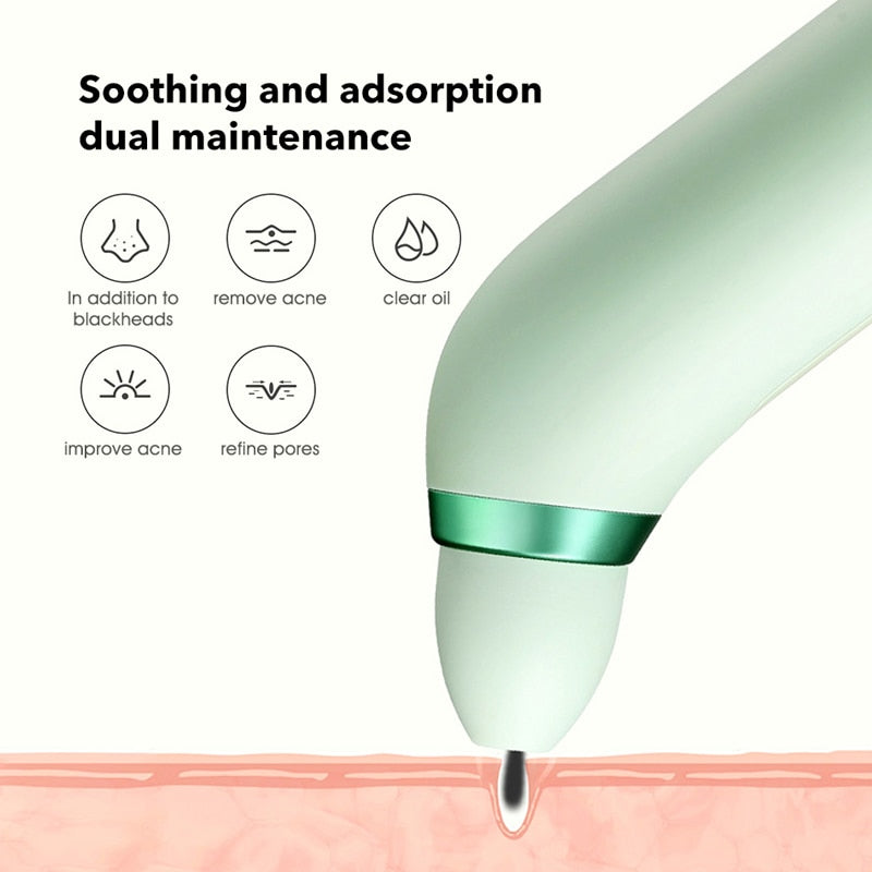 SOOCAS PINJING Blackhead Remover Vacuum Deep Cleaning