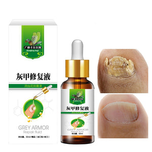 Fungal Nail Repair Essence Serum Treatment Care Foot Nail Fungus Removal Gel Anti Infection Paronychia Onychomycosis