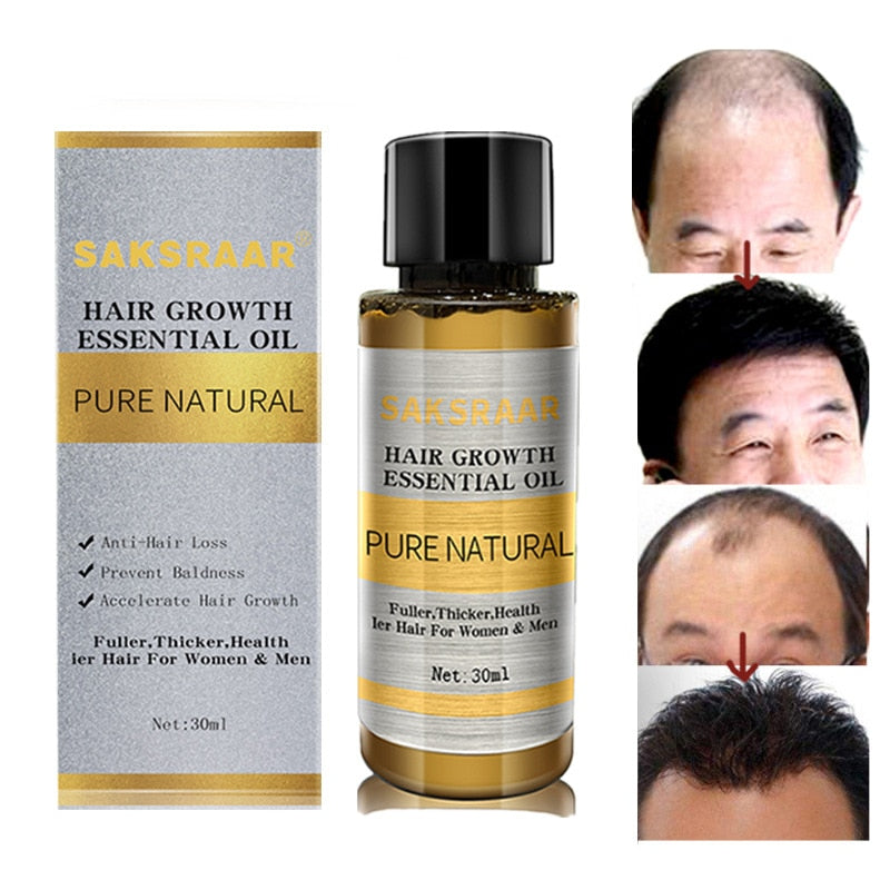 Hair Growth Oils Original 100% Hair Loss Liquid Beauty Dense Hair Growth Serum