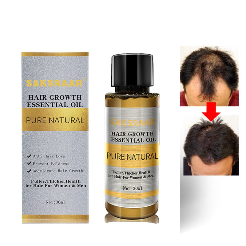 Hair Growth Oils Original 100% Hair Loss Liquid Beauty Dense Hair Growth Serum