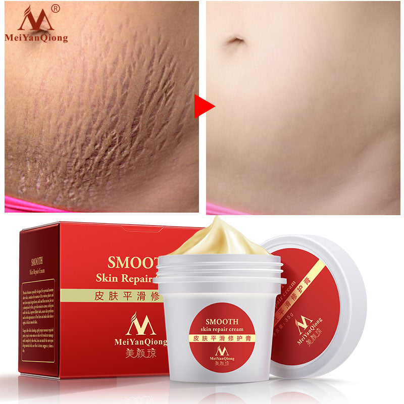 Smooth Skin Stretch Mark Skin Cream Removes Maternal Skin Repair Body Cream Removes Postpartum Scar Care Gentle Moisturizing