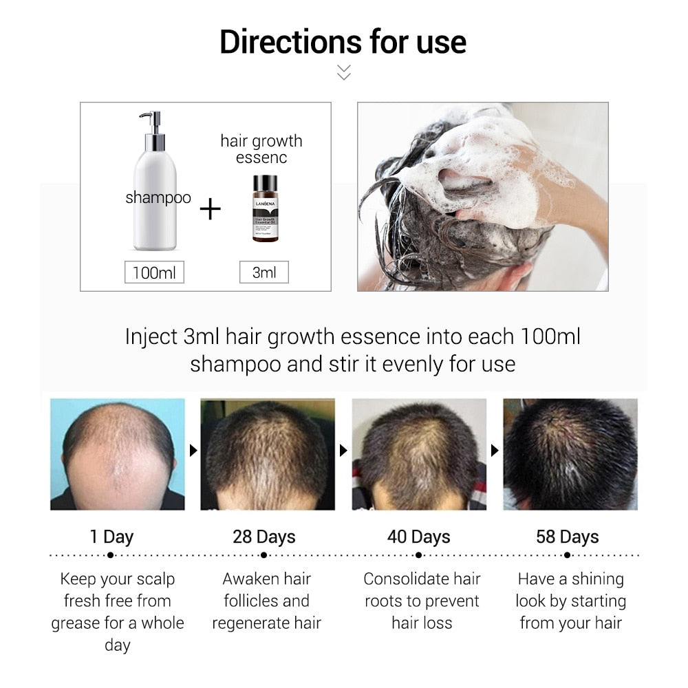 Hair Growth Oil Treatment  Preventing Hair Loss