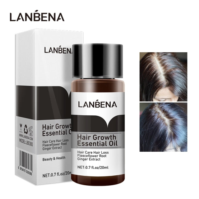 Hair Growth Oil Treatment  Preventing Hair Loss