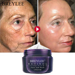 BREYLEE Retinol Firming Face Cream Anti-Aging Wrinkle Removal Day Cream Moisturizing Whitening Firming Lifting Night Cream 40g