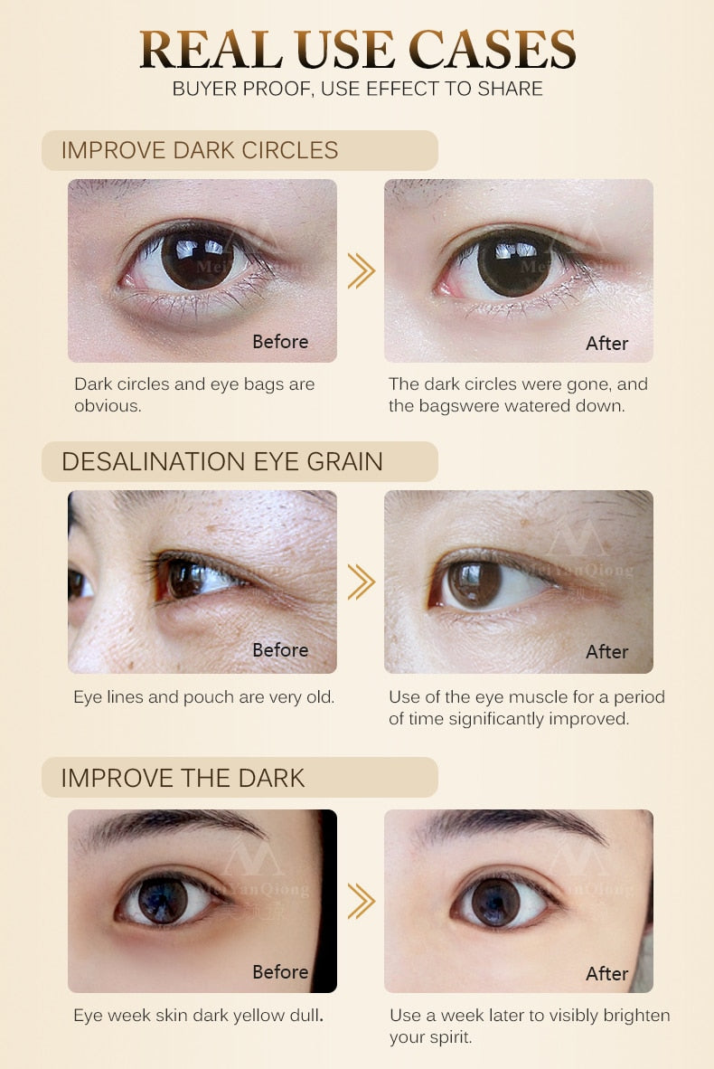 Anti-Wrinkle Eye Cream Remove Dark Circles Remove Dark Circles