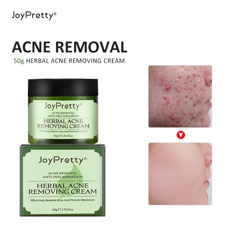 Herbal Against Anti Face Acne Pimple Remover Treatment Cream Patch Cleansing Moisturizing Korean Facial Skin Care Cream Cosmetic