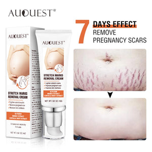 Remove Pregnancy Scars Acne Cream Stretch Mark Treatment Maternity 7 Days Effect ESSENTI OIL Repair Anti-Aging Body Cream 45g