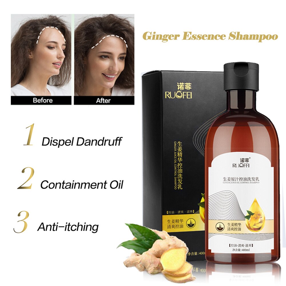 Dispel Dandruff Anit-itching Shampoo Make Hair Stronger/Thicker 400ml Containment Oil Ginger Essence Hair Shampoo for Men/Women