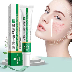 Acne Removal Cream Acne Treatment Fade Acne Spots Skin Care