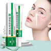 Acne Removal Cream Acne Treatment Fade Acne Spots Skin Care