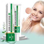 Acne Removal Cream Acne Treatment Fade Acne Spots Skin Care