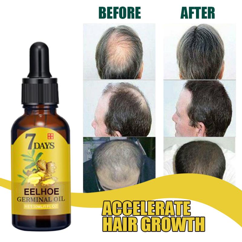 Hair Growth Ginger Oil Fast-growing Nourishing Hair Repair