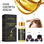 Hair Growth Serum Oil Preventing Hair Lose Liquid