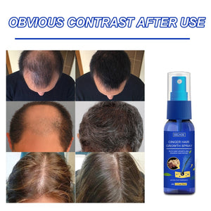 Hair Spray Fast Grow Loss Preventing  Care Dense Beauty