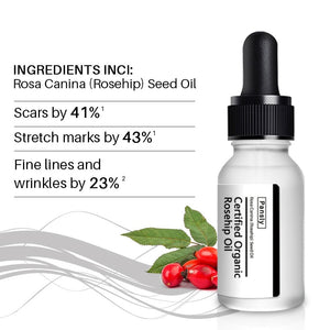 Organic Rosehip Oil  Stretch Marks Acne  Fine Lines Beauty