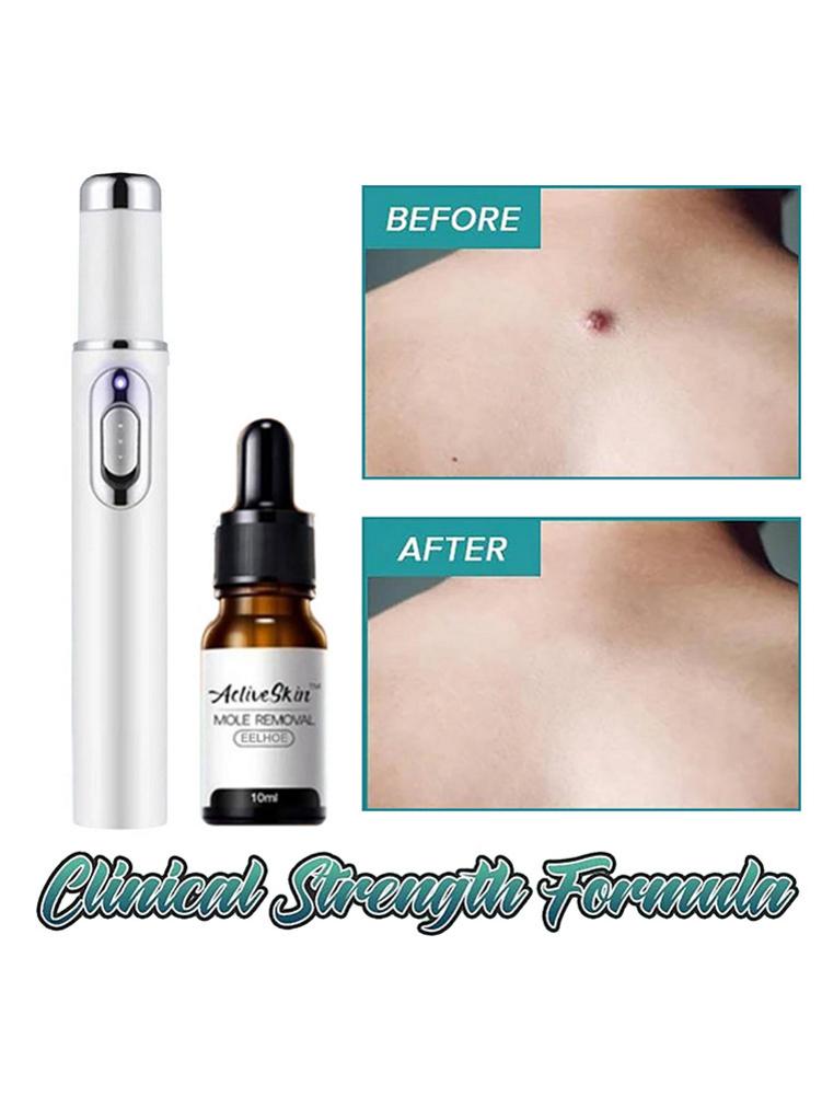 Dark Spot Removal Serum Solutions Pen Set  Skin-Dark-Spot Freckles  Remover