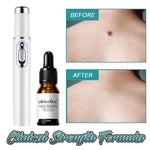 Dark Spot Removal Serum Solutions Pen Set  Skin-Dark-Spot Freckles  Remover