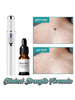 Dark Spot Removal Serum Solutions Pen Set  Skin-Dark-Spot Freckles  Remover