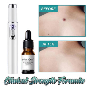 Dark Spot Removal Serum Solutions Pen Set  Skin-Dark-Spot Freckles  Remover