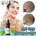 Dark Spot Removal Serum Solutions Pen Set  Skin-Dark-Spot Freckles  Remover