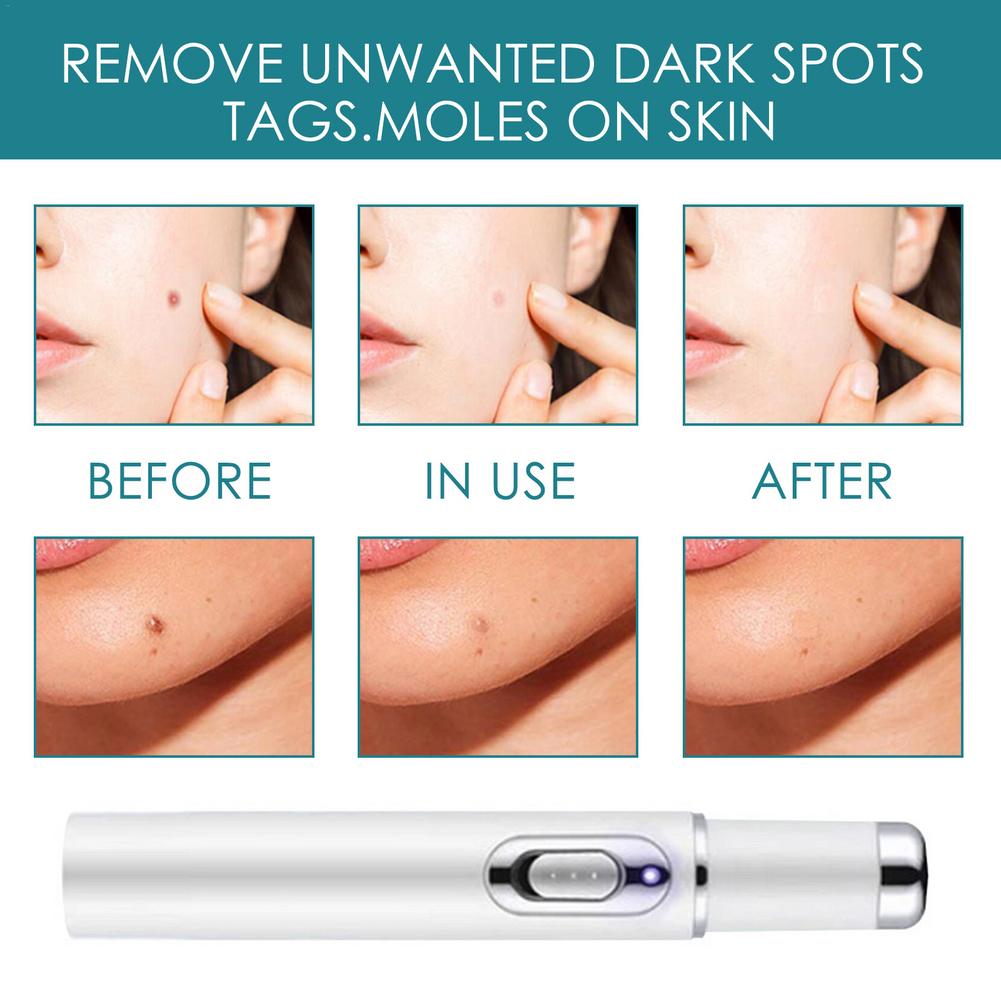 Dark Spot Removal Serum Solutions Pen Set  Skin-Dark-Spot Freckles  Remover