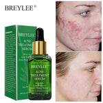 BREYLEE Tea Tree Acne Treatment Face Serum  Moisturizer