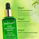 BREYLEE Tea Tree Acne Treatment Face Serum  Moisturizer