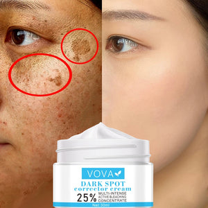 Face Cream Whitening  Moisturizing Remove Freckle