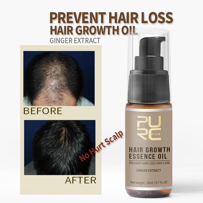 Fast Growing Hair Oil Repair Hair Loss Care Spray Beauty Hair