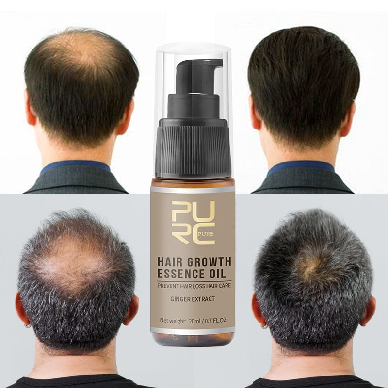 Fast Growing Hair Oil Repair Hair Loss Care Spray Beauty Hair