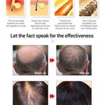 Fast Growing Hair Oil Repair Hair Loss Care Spray Beauty Hair