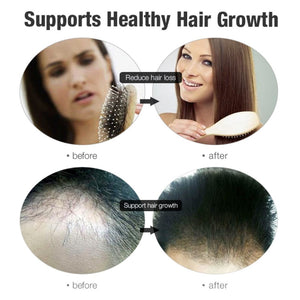 Fast Growing Hair Oil Repair Hair Loss Care Spray Beauty Hair