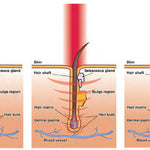 Laser Treatment Cap Stop Hair Loss For Thinning Hair Of Men