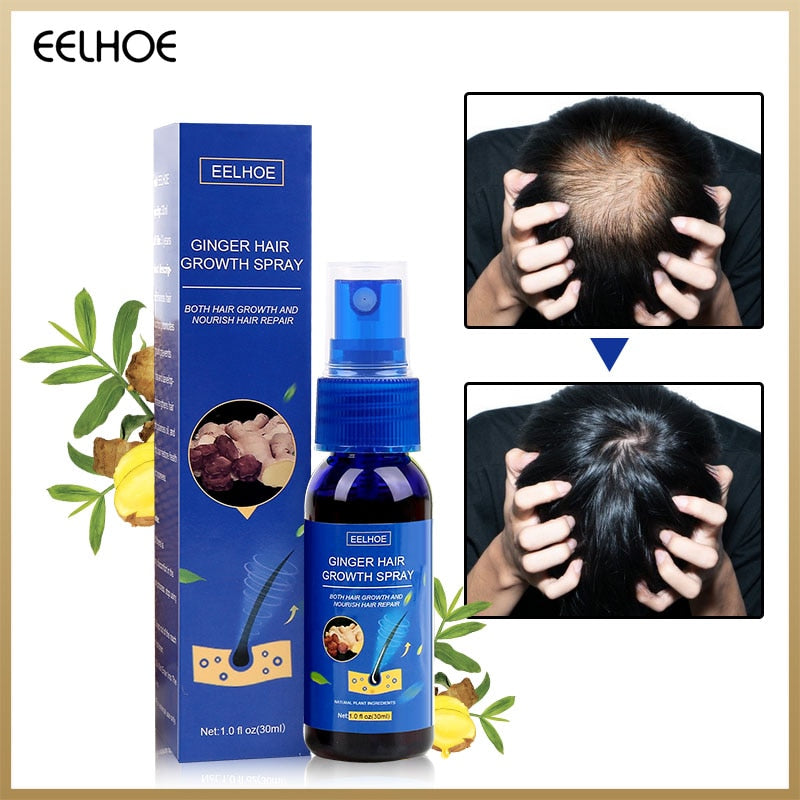 EELHOE Hair Growth Spray 30ml Fast Grow Hair Oil