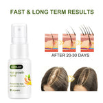 Hair Growth Ginger Spray Stop Hair Loss