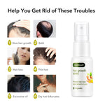 Hair Growth Ginger Spray Stop Hair Loss