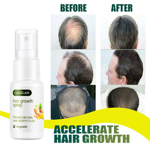 Hair Growth Ginger Spray Stop Hair Loss