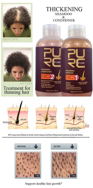 PURC Hair Shampoo and Conditioner for Hair Growth and Hair loss